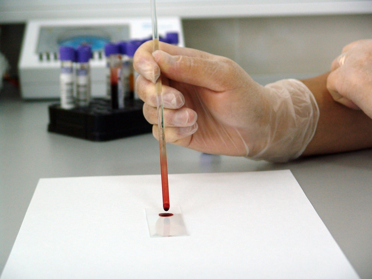 Une analyse de sang peut aider à détecter une adénopathie mésentérique
